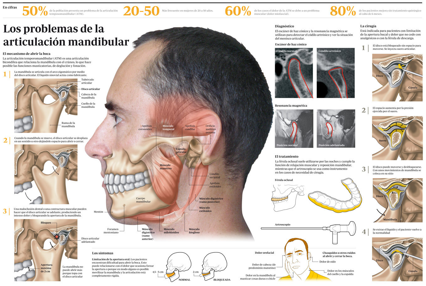 Infografía por Antonio Berrocal Infografía